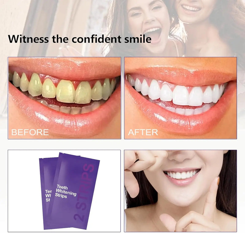 Purple Teeth Whitening Kit – Remove Plaque & Stains Instant Color Corrector